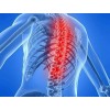 脊髓炎治疗方案