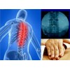 全国第八届脊椎矫正整脊手法影像诊疗技术研修班
