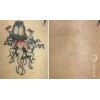 广州星影刺青进口皮秒洗纹身有效的纹身“后悔药”！