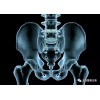 龙氏正骨是如何治疗骨盆旋移的