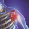 老年肩周炎有什么特点？怎么缓解肩周炎疼痛？